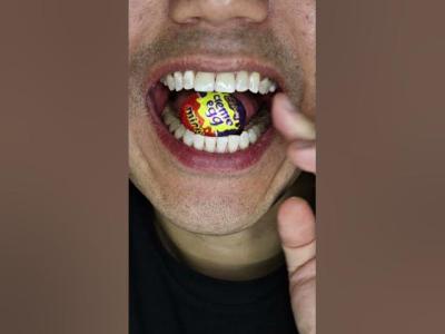 ASMR  Mini Cadbury Creme Egg DoctorTristanPeh ASMR