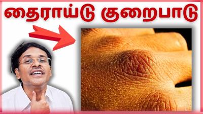 நஙகள கணணல பரகக கடய 15 தரயட ஹரமன கறவ அறகறகள 15 signs of low thyroid